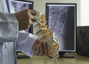 A neurosurgeon using pencil pointing at lumbar vertebra model