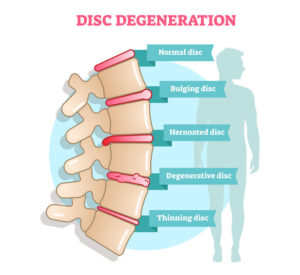 spine explained